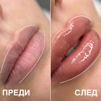 SE'LIPS™ - Lip plump (Гланц за устни с хиалуронов ефект)